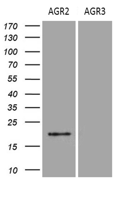 SAMD12 Antibody