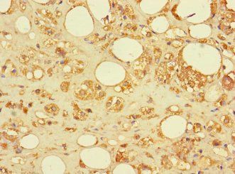 SAMD12 Antibody