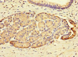 SAMD12 Antibody
