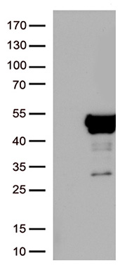 DLGAP3 Antibody