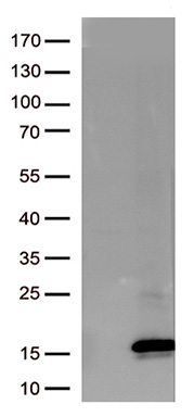 DLGAP3 Antibody