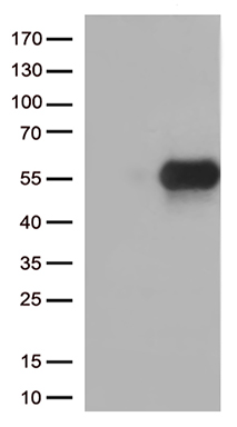 DLGAP3 Antibody