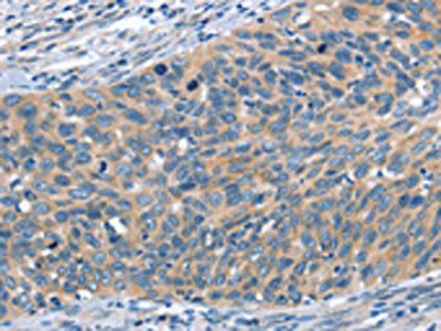 SCARB1 Antibody
