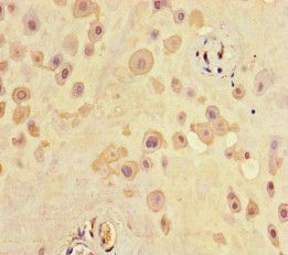 SCG2 Antibody