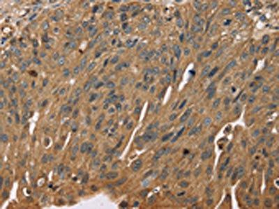 SCGB2A1 Antibody