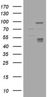 SCHIP1 Antibody