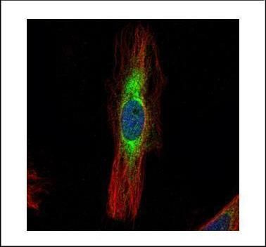 SCIN Rabbit Polyclonal Antibody