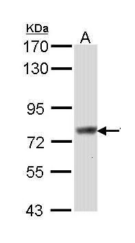 SCIN Rabbit Polyclonal Antibody