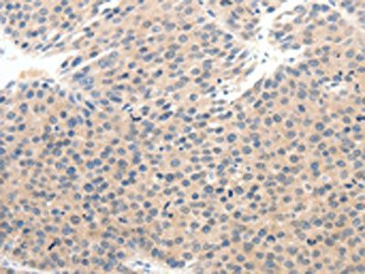 SCN10A Antibody
