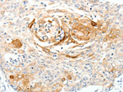 SCN10A Antibody