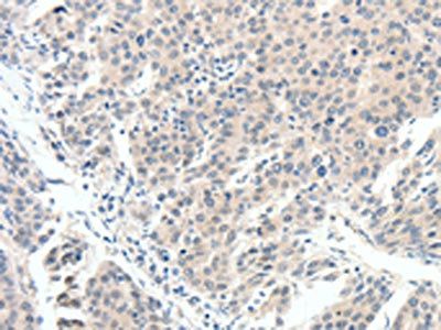 SCN10A Antibody