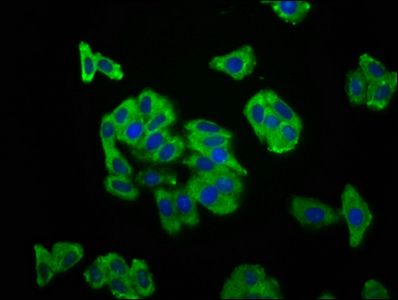 SCN11A Antibody