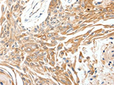 SCN11A Antibody