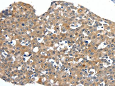 SCN11A Antibody