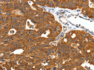 SCN11A Antibody