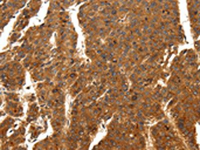 SCN11A Antibody