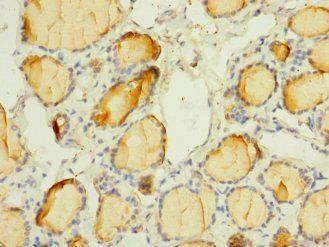SCN3A Antibody