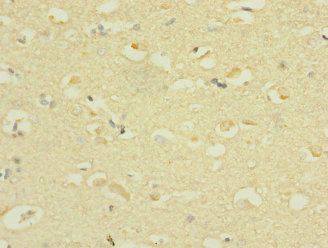 SCN3A Antibody