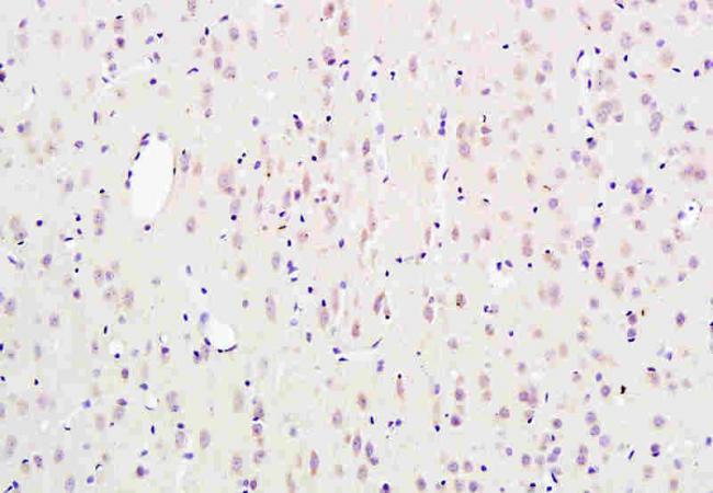 SCN3B Rabbit Polyclonal Antibody