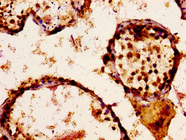 SCN9A Antibody