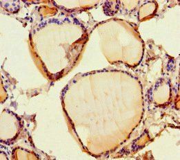 SCPEP1 Antibody