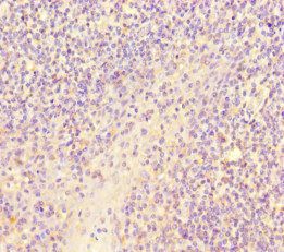 SCPEP1 Antibody