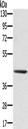 SCPEP1 Antibody