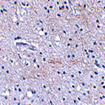 SCRAPPER Rabbit Polyclonal Antibody