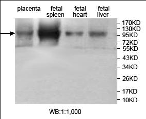 JHDM1D Rabbit Polyclonal Antibody