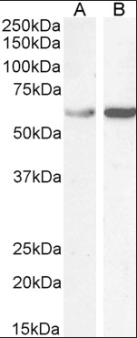 Goat anti-TCP1 Antibody