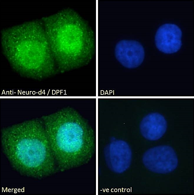 Neuro-d4/DPF1 Antibody