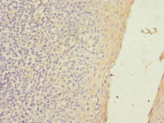 SLC23A2 Antibody