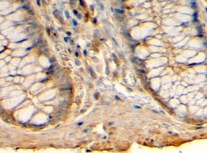 Goat anti-ACADM Antibody