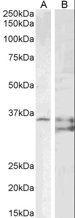 Sgta (mouse aa84-97) Antibody