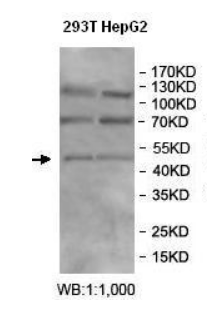 BEND5 Rabbit Polyclonal Antibody