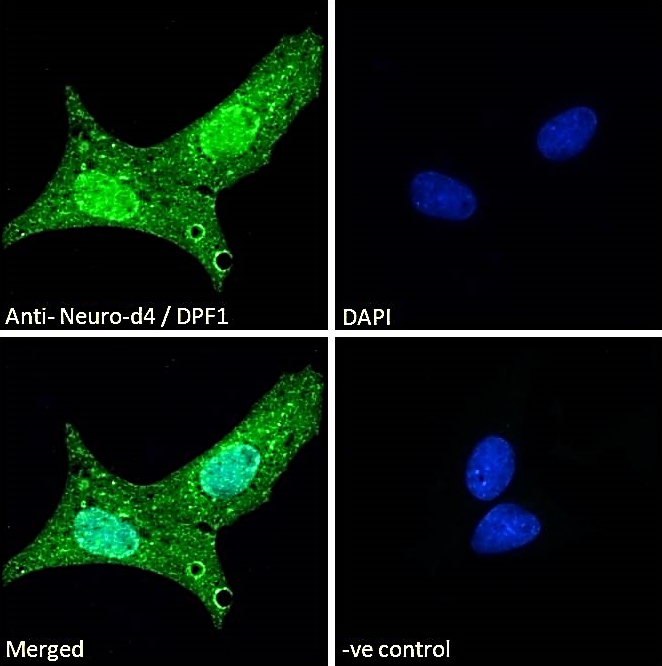Neuro-d4/DPF1 Antibody