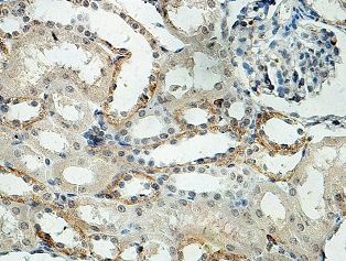 KRCC1 Rabbit Polyclonal Antibody