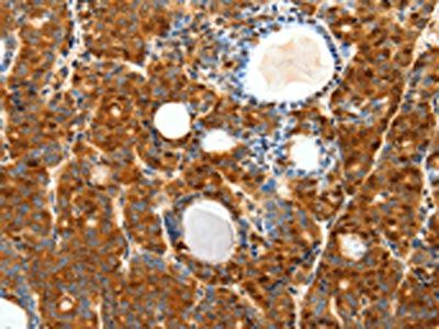 SCTR Antibody