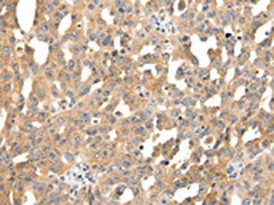 SCTR Antibody