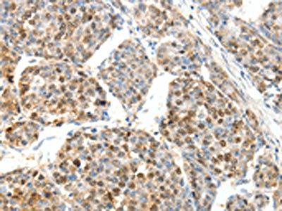 SCTR Antibody