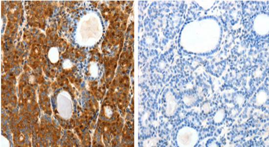 SCTR Rabbit Polyclonal Antibody