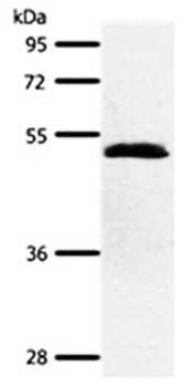 SCTR Rabbit Polyclonal Antibody