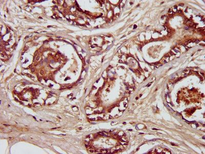 ENTR1 Antibody