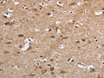 SDCCAG3 Antibody