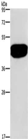 SDCCAG3 Antibody