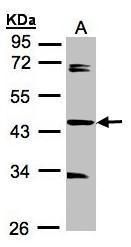 SDCCAG3 Rabbit Polyclonal Antibody