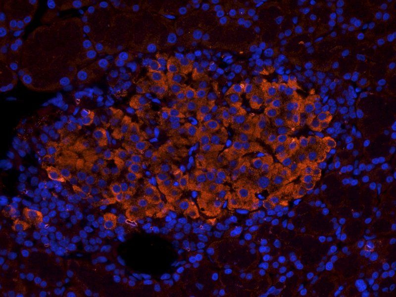 SDF1 antibody
