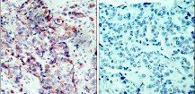 SEK1/MKK4 (Phospho-Ser80) Antibody