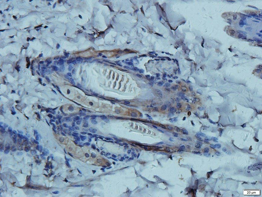 SEMA3A antibody