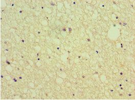 SEMA4C Antibody